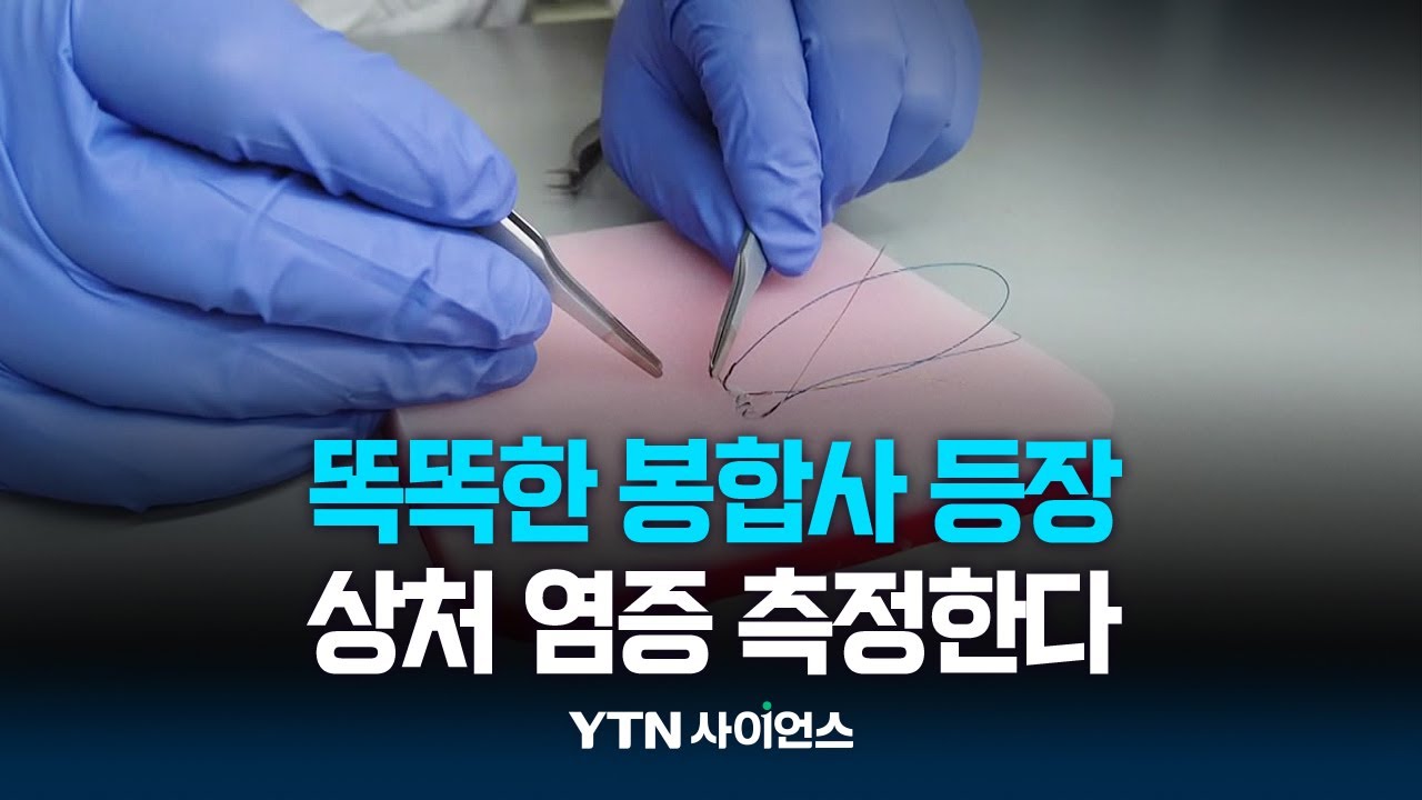 상처 꿰맸더니...얼마나 나았는지 알려주는 똑똑한 봉합사