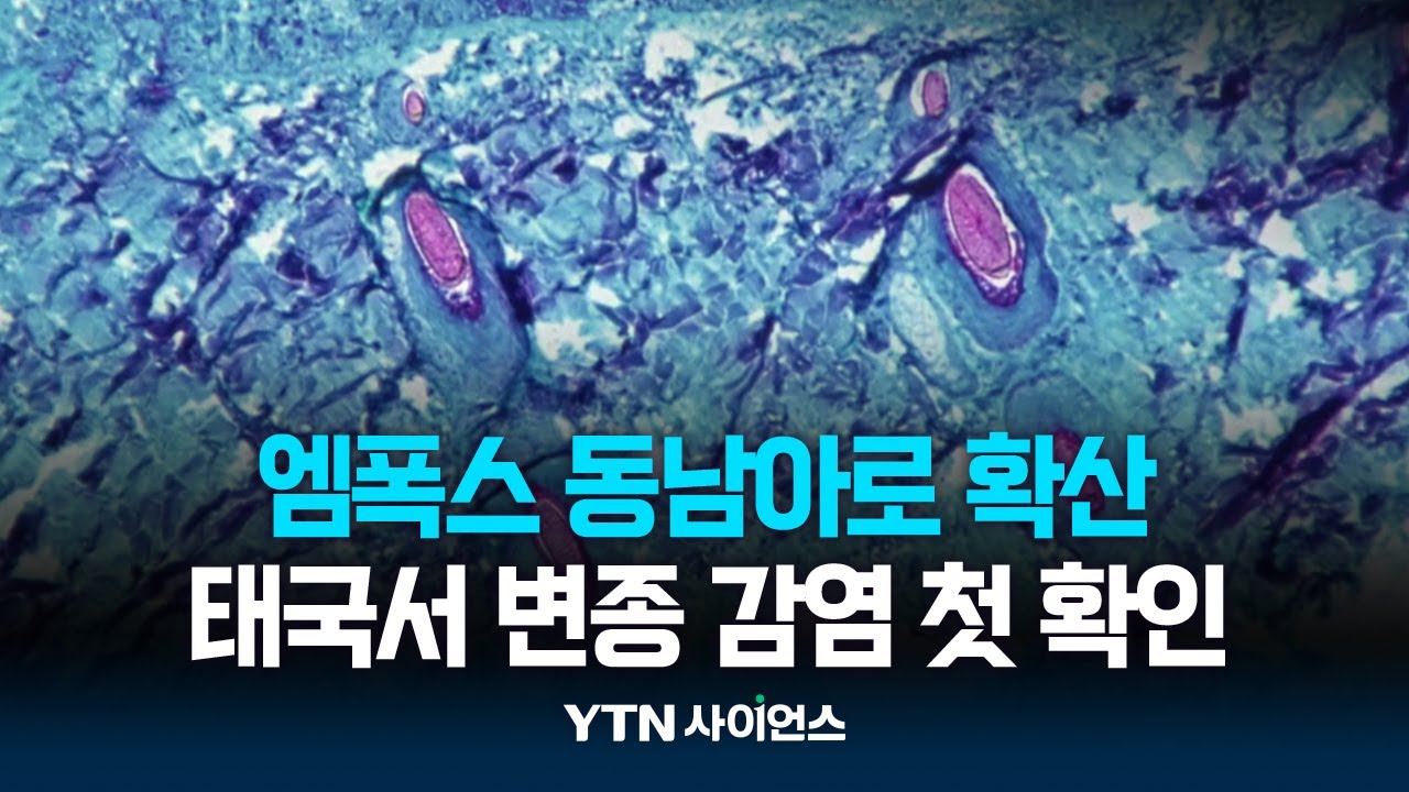 엠폭스 동남아로 확산...태국서 변종 감염 첫 확인