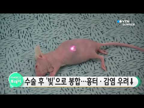 [사이언스 TV] 수술 후 '빛'으로 봉합…흉터·감염 우려↓