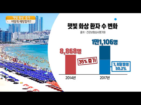 [사이언스TV] 여름철 햇빛 화상 환자 증가, 주의할 점은