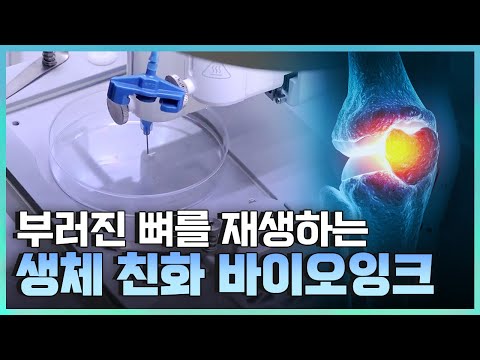 [기술자들] 차세대 의료 분야를 이끌어 갈 기술