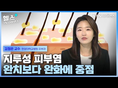 지루성 피부염, 세안 및 샴푸법은? _ 김정은 교수(한양대학교병원 피부과)