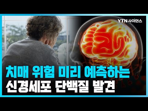 [과학뉴스] 치매 위험 예측할 수 있는 신경세포 단백질 발견