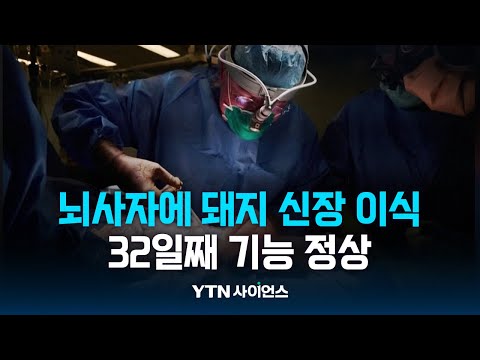 美, 뇌사자에 유전자 조작 돼지 신장 이식...32일 정상 기능