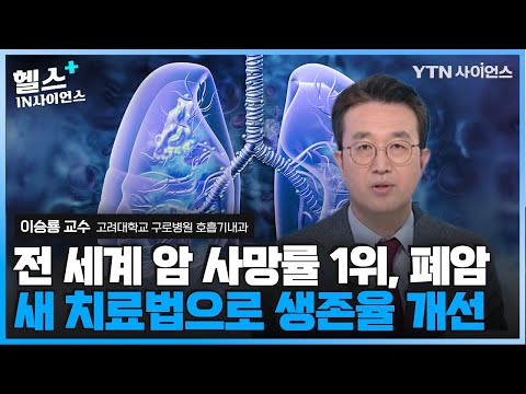 담배 끊으면 폐암 사망률 절반으로 감소..폐암 생존율 높이는 '면역 항암제' 병용요법, 항암치료보다 부작용도 적다