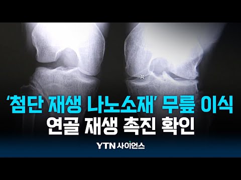 손상된 무릎 연골 치료하는 첨단 재생 나노소재 기술 개발